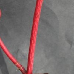 Acer pensylvanicum 'Erythrocladum'